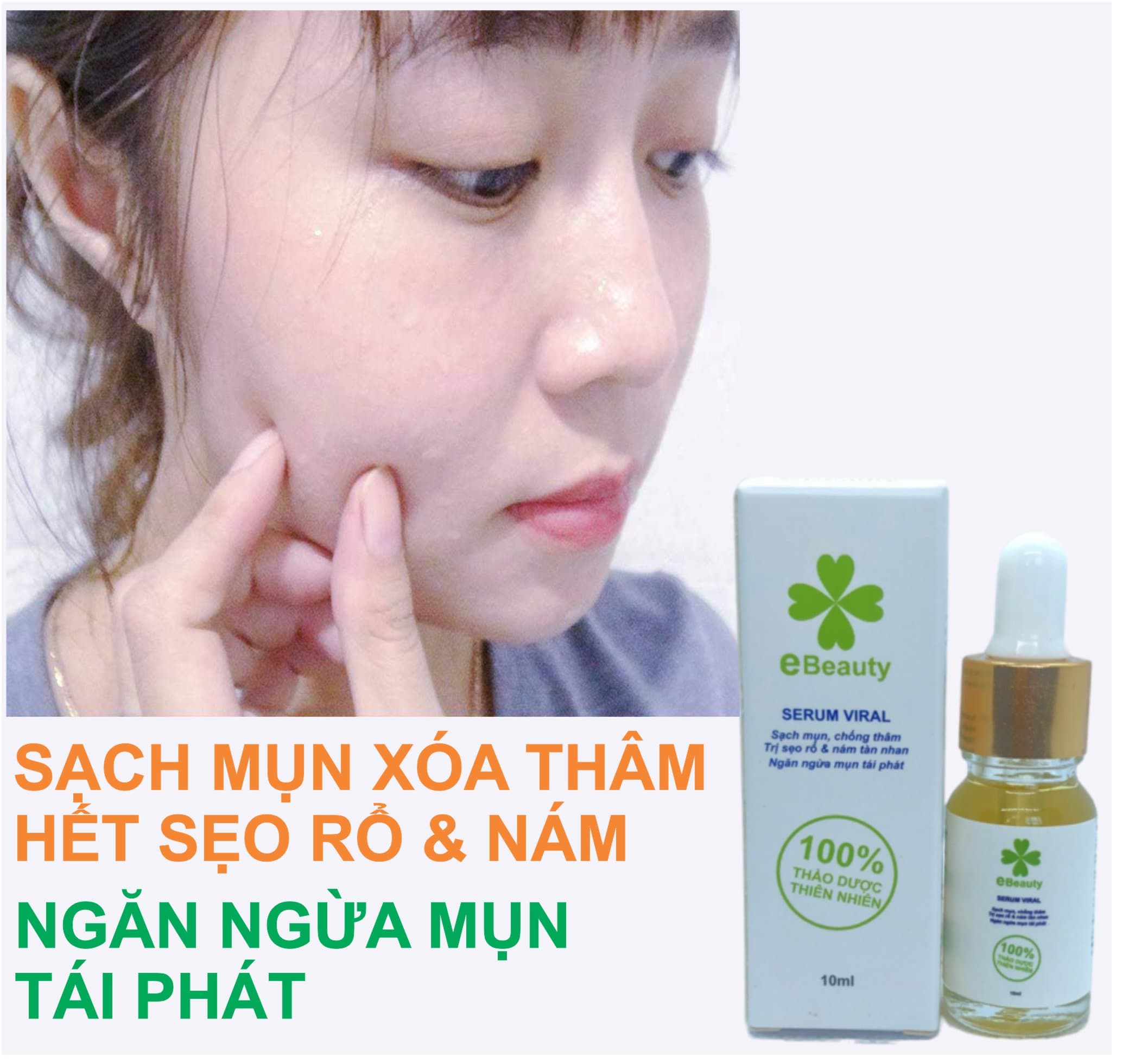 Serum sạch mụn xóa thâm sẹo rổ nám tàn nhang EBeauty Viral 10ml