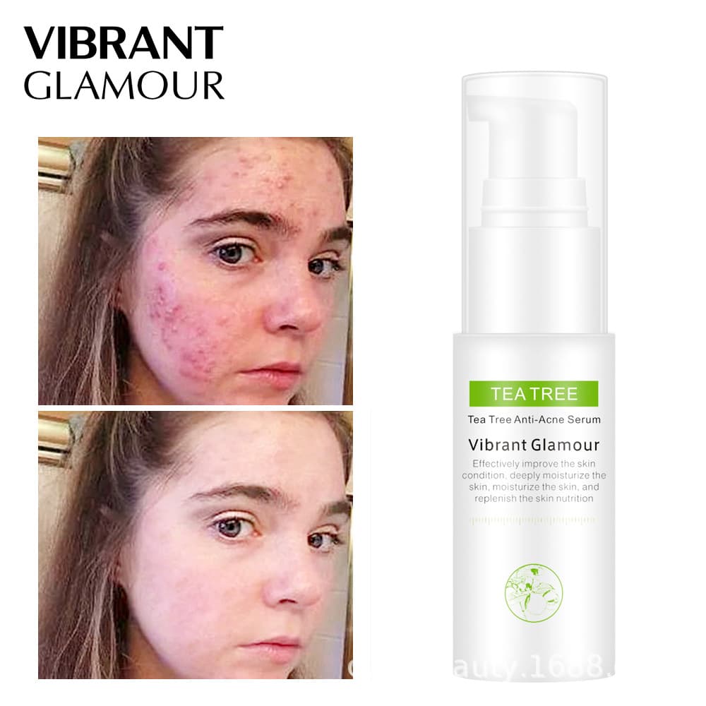 [HCM][Peachy Sis Shop] Toner trà xanh chống mụn sẹo thu nhỏ lỗ chân lông kiểm soát dầu dưỡng trắng da 30ml VIBRANT GLAMOUR